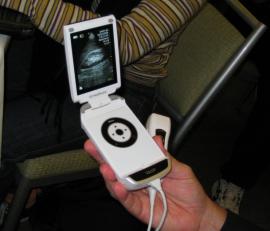 GE ultrasound